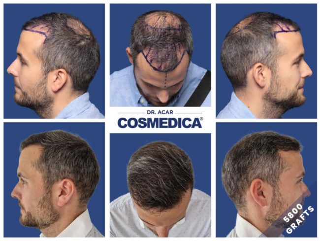 cosmedica_dr.acar_3-650x489